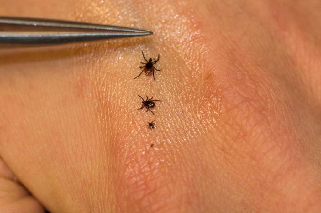 A line of ticks on a person's skin showing lifestages